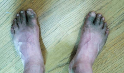 picture of dirty feet